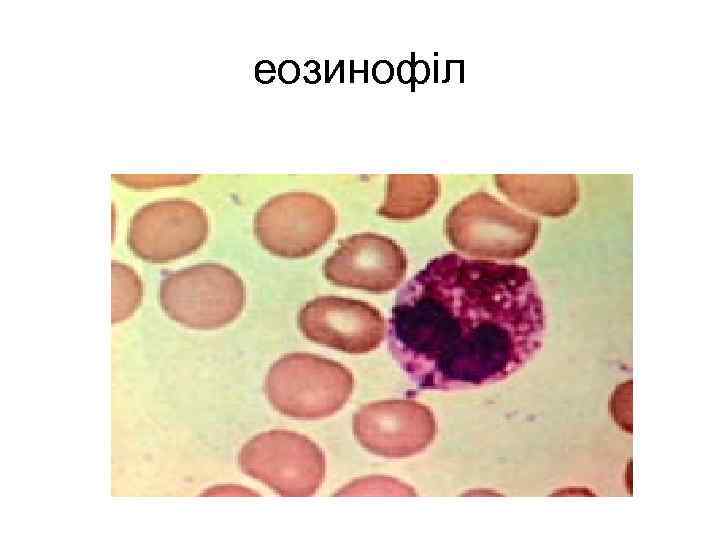 еозинофіл 