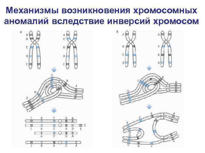 Хромосомные болезни проект