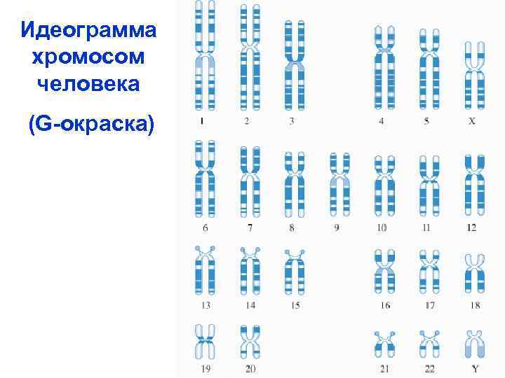 Окраска хромосом. Дифференциальная g-окраска хромосом. Схема дифференциального окрашивания хромосом человека. R окрашивание хромосом.