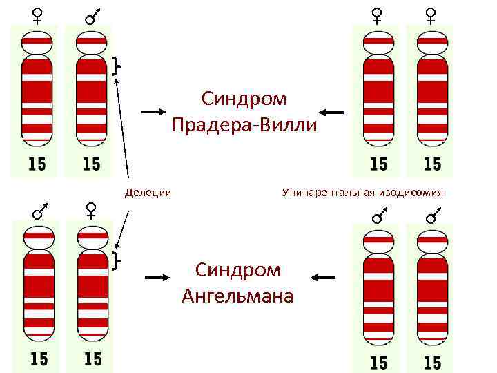 Синдром Прадера-Вилли Делеции Унипарентальная изодисомия Синдром Ангельмана 