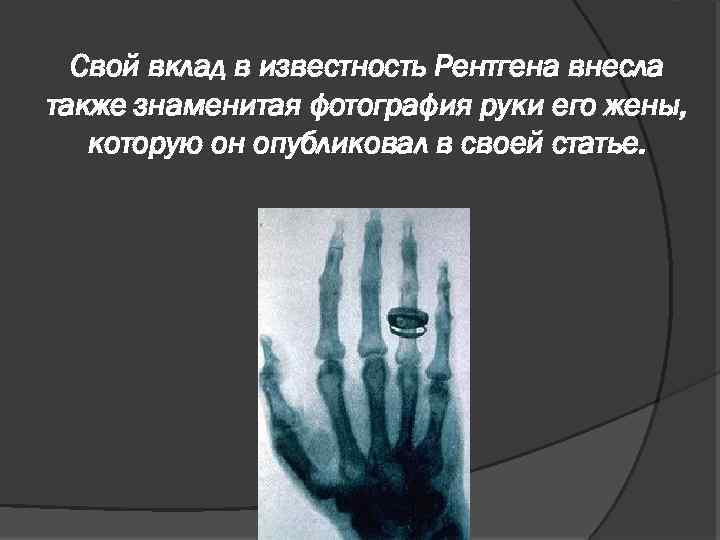 Свой вклад в известность Рентгена внесла также знаменитая фотография руки его жены, которую он
