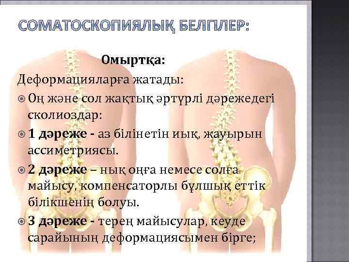  Омыртқа: Деформацияларға жатады: Оң және сол жақтық әртүрлі дәрежедегі сколиоздар: 1 дәреже -