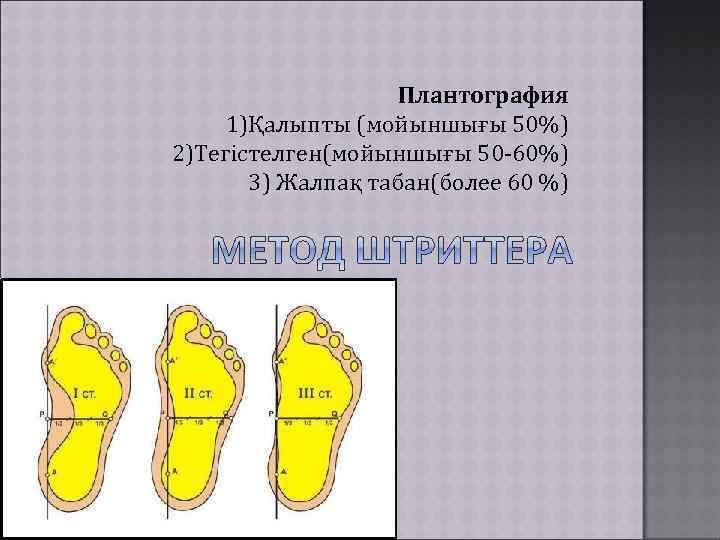  Плантография 1)Қалыпты (мойыншығы 50%) 2)Тегістелген(мойыншығы 50 -60%) 3) Жалпақ табан(более 60 %) 