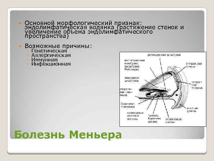  Основной морфологический признак: эндолимфатическая водянка (растяжение стенок и увеличение объема эндолимфатического пространства) Возможные