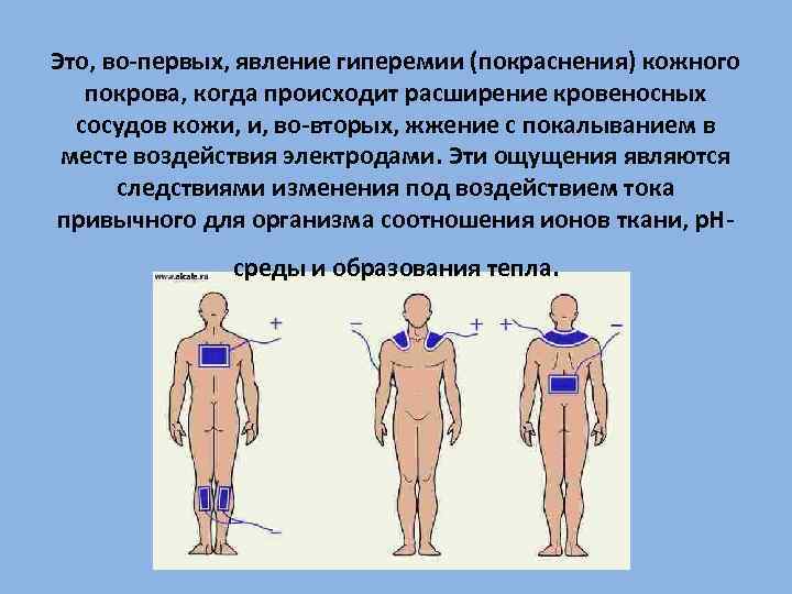 Это, во первых, явление гиперемии (покраснения) кожного покрова, когда происходит расширение кровеносных сосудов кожи,