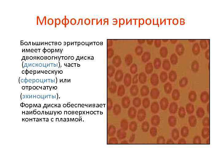Морфология эритроцитов Большинство эритроцитов имеет форму двояковогнутого диска (дискоциты), часть сферическую (сфероциты) или отросчатую