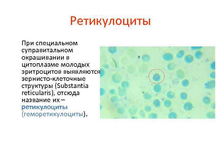 Ретикулоциты При специальном суправитальном окрашивании в цитоплазме молодых эритроцитов выявляются зернисто-клеточные структуры (Substantia reticularis),