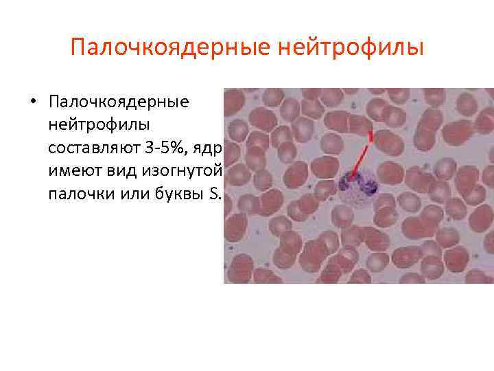 Палочкоядерные нейтрофилы • Палочкоядерные нейтрофилы составляют 3 -5%, ядра имеют вид изогнутой палочки или