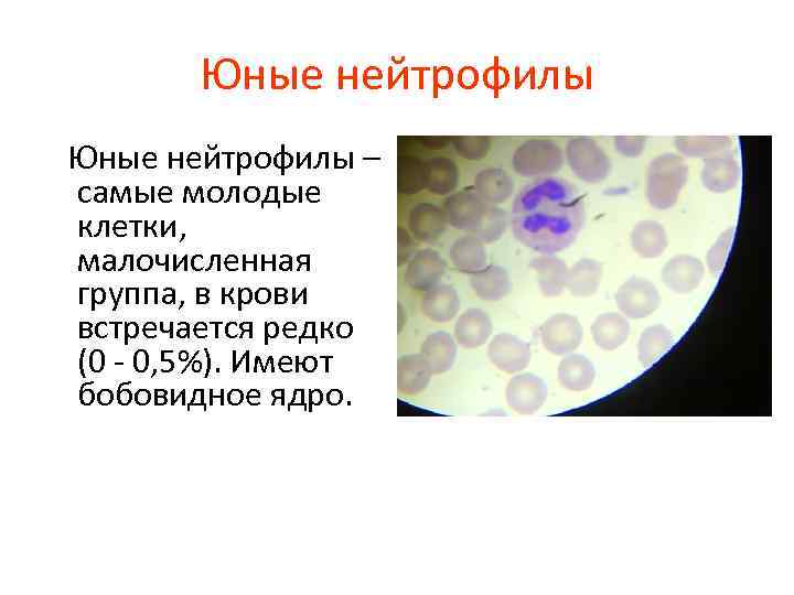 Юные нейтрофилы – самые молодые клетки, малочисленная группа, в крови встречается редко (0 -