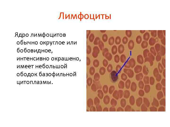 Лимфоциты Ядро лимфоцитов обычно округлое или бобовидное, интенсивно окрашено, имеет небольшой ободок базофильной цитоплазмы.