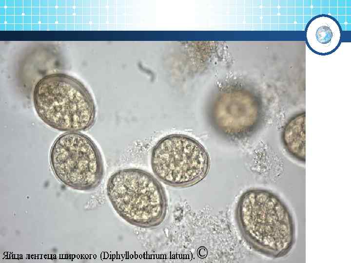 Яйца гельминтов фото под микроскопом