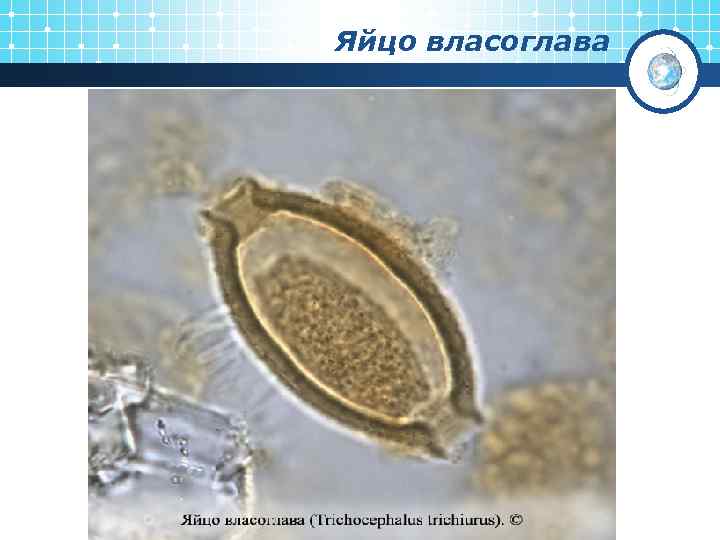 Яйцо власоглава 