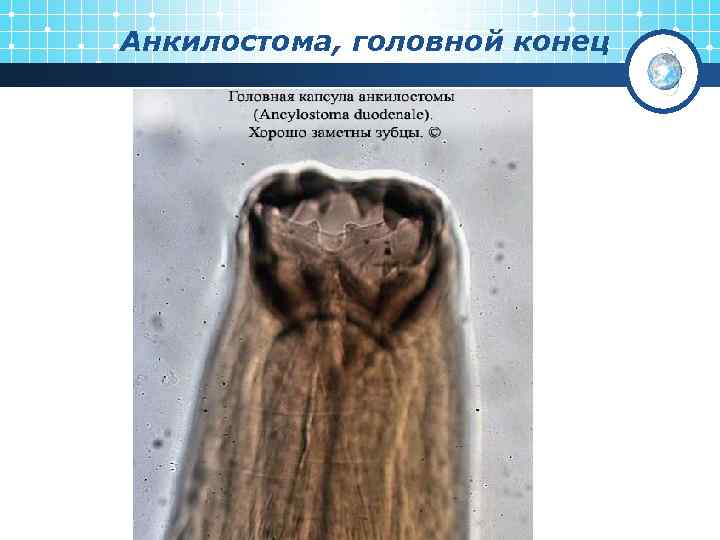 Анкилостома, головной конец 