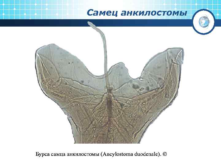 Самец анкилостомы 