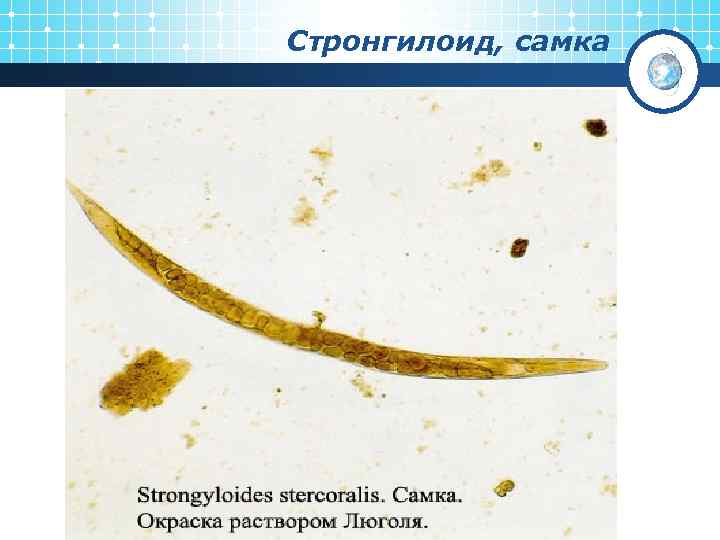 Стронгилоид, самка 