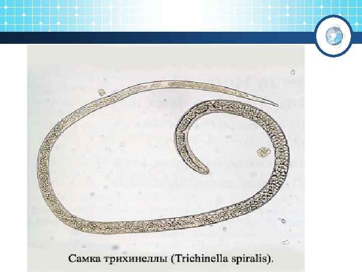 Строение трихинеллы рисунок