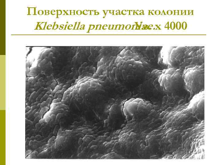 Поверхность участка колонии Klebsiella pneumoniae. х 4000 Ув. 