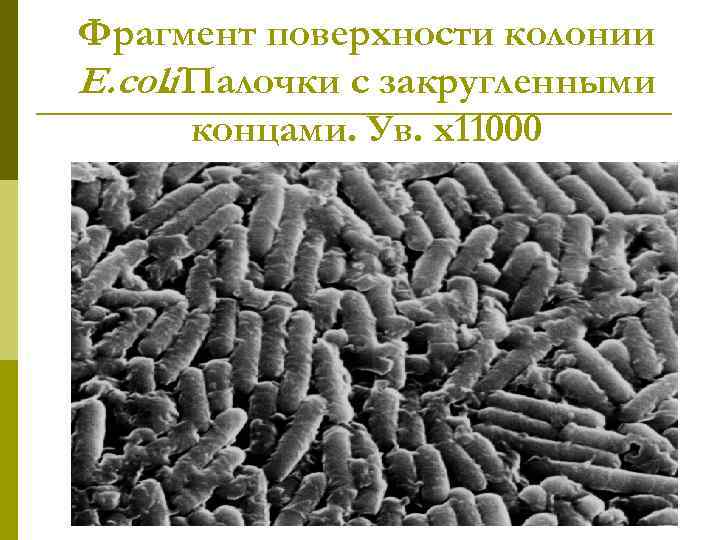 Фрагмент поверхности колонии E. coli Палочки с закругленными. концами. Ув. х11000 