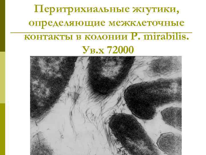 Перитрихиальные жгутики, определяющие межклеточные контакты в колонии P. mirabilis. Ув. х 72000 