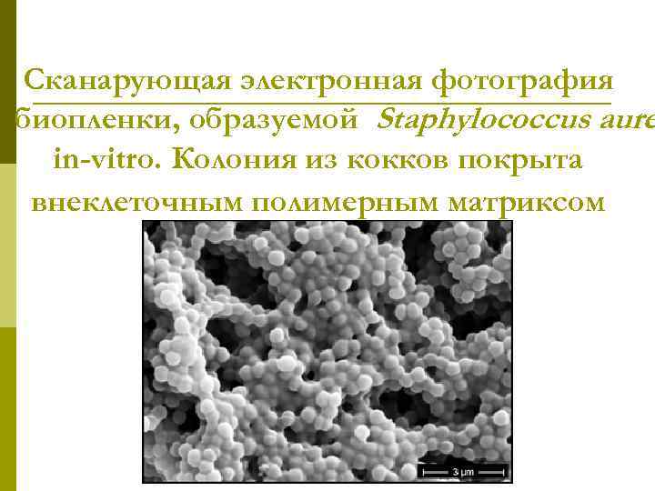 Сканарующая электронная фотография биопленки, образуемой Staphylococcus aure in-vitro. Колония из кокков покрыта внеклеточным полимерным