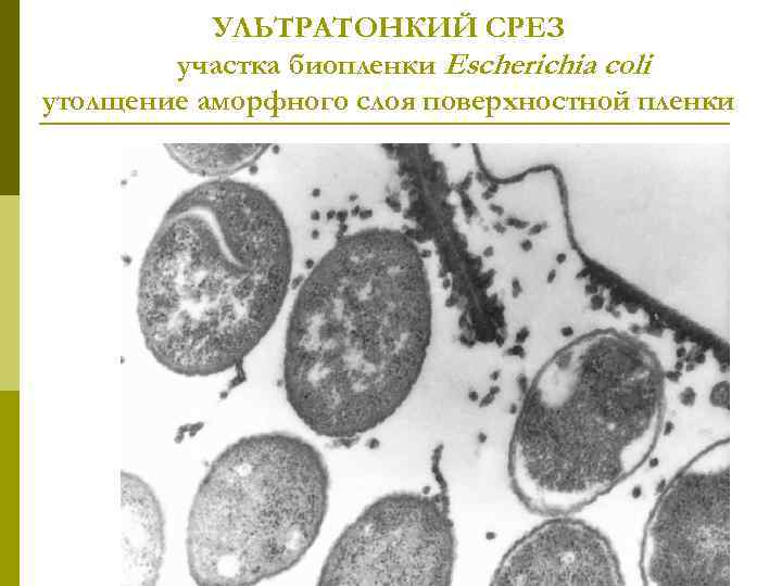 УЛЬТРАТОНКИЙ СРЕЗ участка биопленки Escherichia coli утолщение аморфного слоя поверхностной пленки 