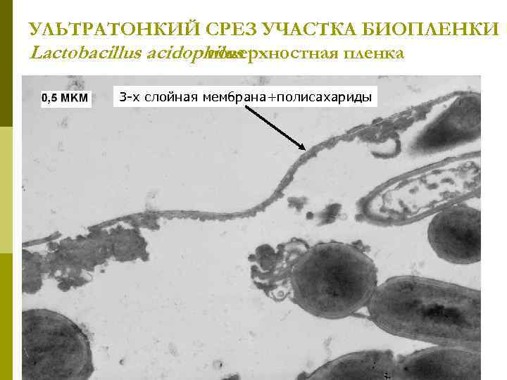 УЛЬТРАТОНКИЙ СРЕЗ УЧАСТКА БИОПЛЕНКИ Lactobacillus acidophilus поверхностная пленка 3 -х слойная мембрана+полисахариды 