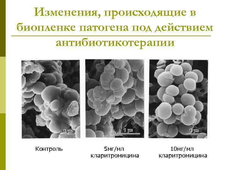 Изменения, происходящие в биопленке патогена под действием антибиотикотерапии Контроль 5 мг/мл кларитромицина 10 мг/мл