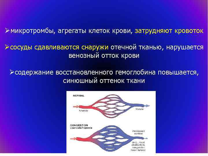 Øмикротромбы, агрегаты клеток крови, затрудняют кровоток Øсосуды сдавливаются снаружи отечной тканью, нарушается венозный отток