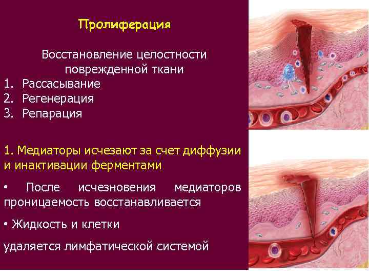 Пролиферация Восстановление целостности поврежденной ткани 1. Рассасывание 2. Регенерация 3. Репарация 1. Медиаторы исчезают