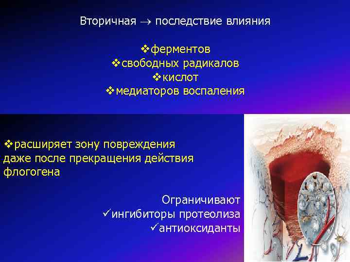 Вторичная последствие влияния vферментов vсвободных радикалов vкислот vмедиаторов воспаления vрасширяет зону повреждения даже после