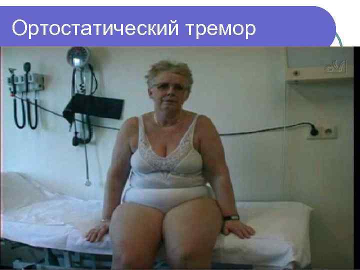 Ортостатический тремор 