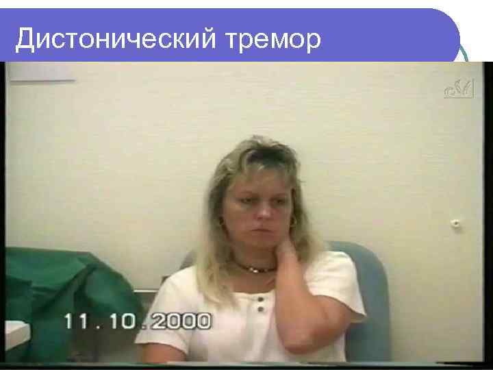 Дистонический тремор 