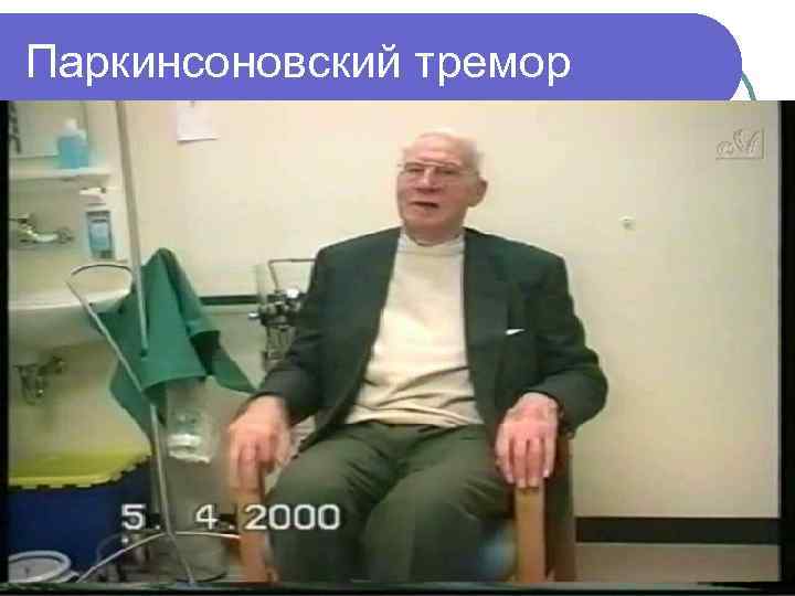 Паркинсоновский тремор 