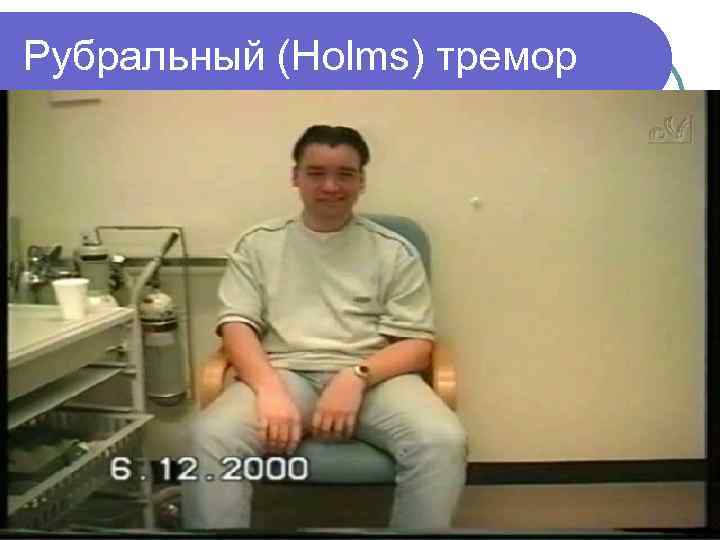 Рубральный (Holms) тремор 