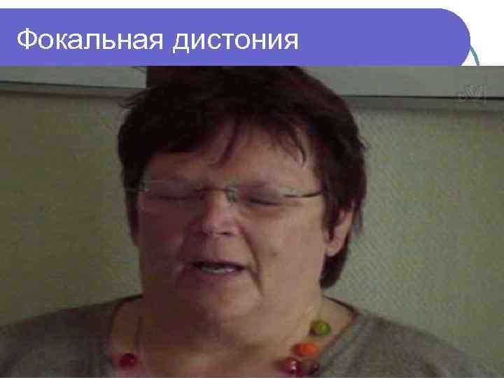 Фокальная дистония 