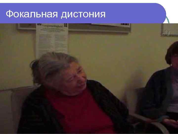 Фокальная дистония 