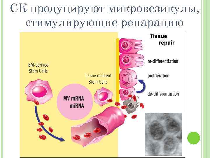СК продуцируют микровезикулы, стимулирующие репарацию 