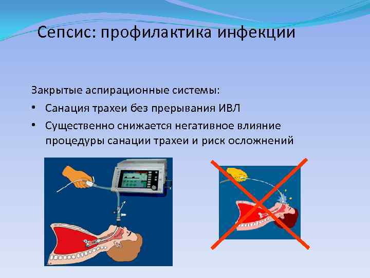 Сепсис: профилактика инфекции Закрытые аспирационные системы: • Санация трахеи без прерывания ИВЛ • Существенно