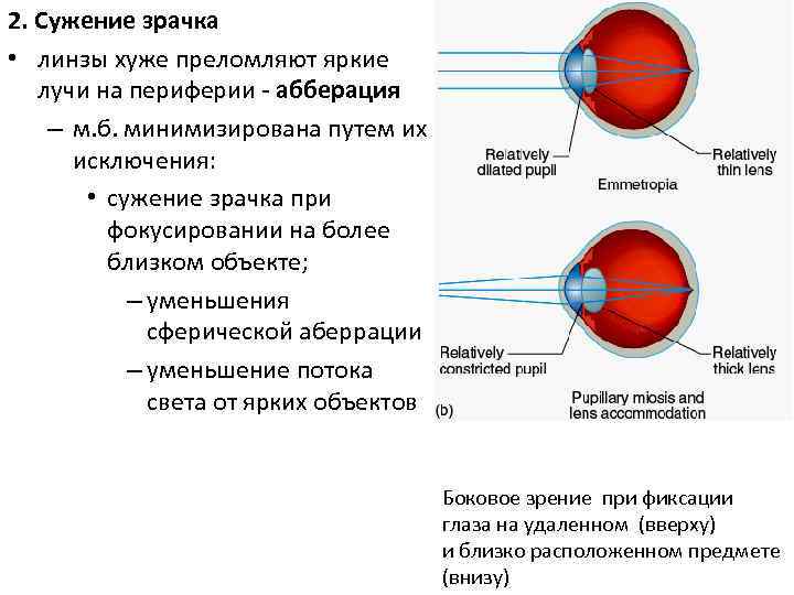 2. Сужение зрачка • линзы хуже преломляют яркие лучи на периферии - абберация –