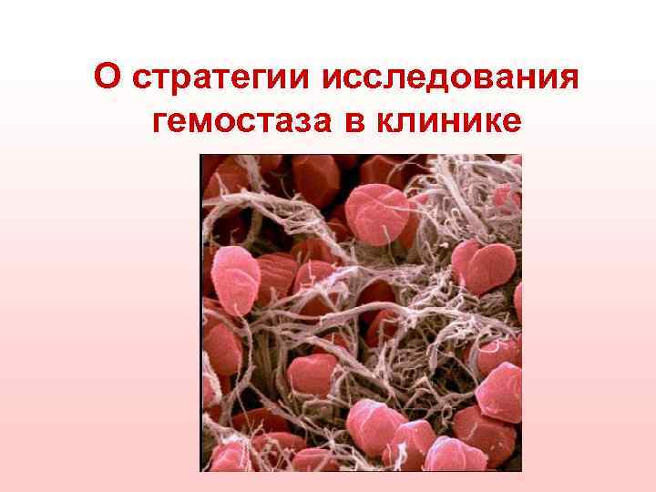 О стратегии исследования гемостаза в клинике 
