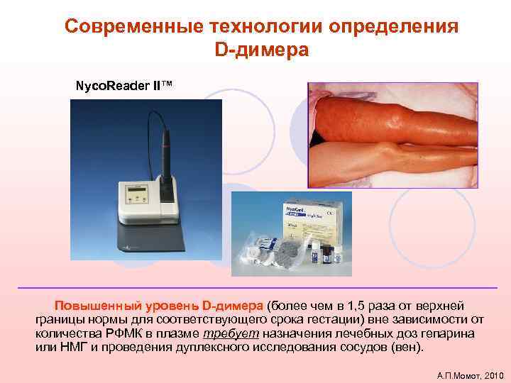 Современные технологии определения D-димера Nyco. Reader II™ Повышенный уровень D-димера (более чем в 1,