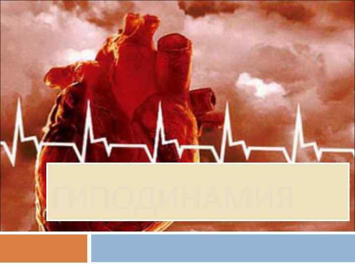 ГИПОДИНАМИЯ 