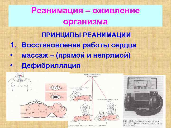 Реанимация – оживление организма ПРИНЦИПЫ РЕАНИМАЦИИ 1. Восстановление работы сердца • массаж – (прямой