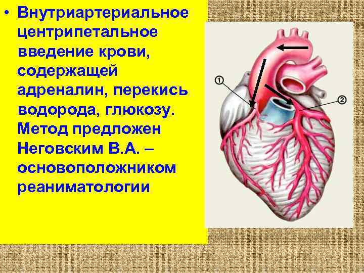  • Внутриартериальное центрипетальное введение крови, содержащей адреналин, перекись водорода, глюкозу. Метод предложен Неговским
