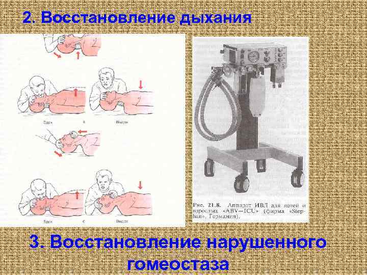2. Восстановление дыхания 3. Восстановление нарушенного гомеостаза 