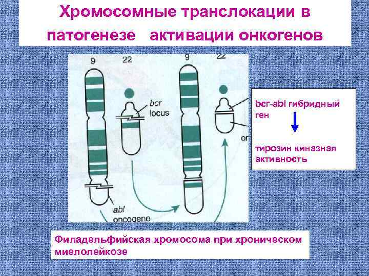 Хромосомные транслокации в патогенезе активации онкогенов bcr-abl гибридный ген тирозин киназная активность Филадельфийская хромосома