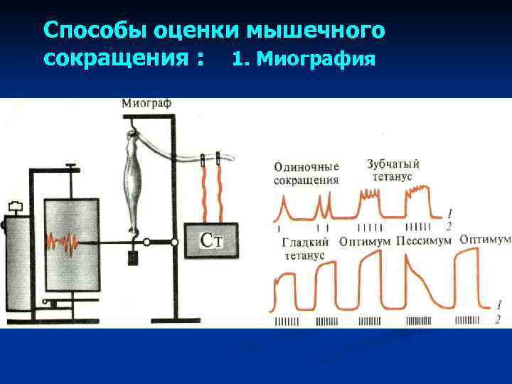 Способы оценки мышечного сокращения : 1. Миография 