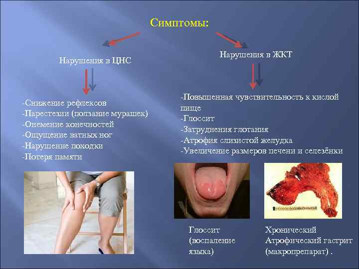 Симптомы: Нарушения в ЦНС -Снижение рефлексов -Парестезии (ползание мурашек) -Онемение конечностей -Ощущение ватных ног