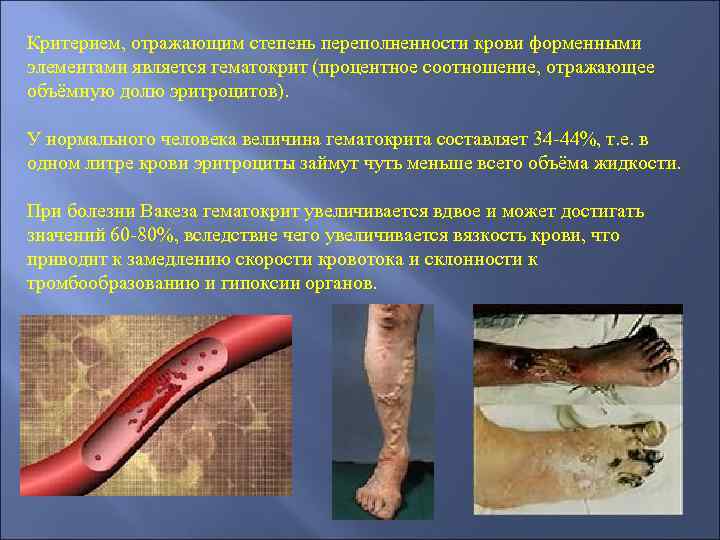 Критерием, отражающим степень переполненности крови форменными элементами является гематокрит (процентное соотношение, отражающее объёмную долю