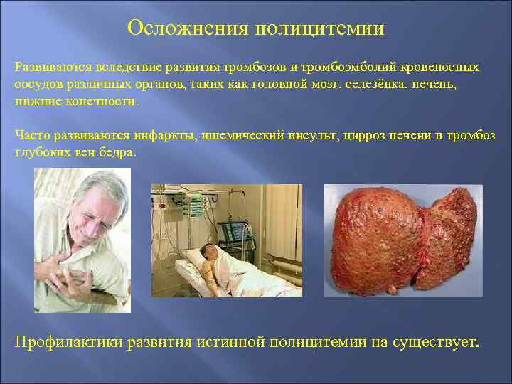 Осложнения полицитемии Развиваются вследствие развития тромбозов и тромбоэмболий кровеносных сосудов различных органов, таких как